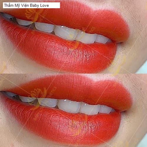 Hình ảnh Thẩm Mỹ Viện Baby Love