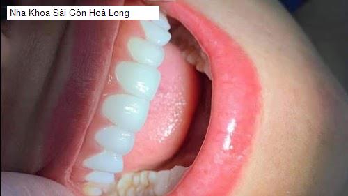 Hình ảnh Nha Khoa Sài Gòn Hoà Long