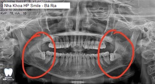 Hình ảnh Nha Khoa HP Smile - Bà Rịa